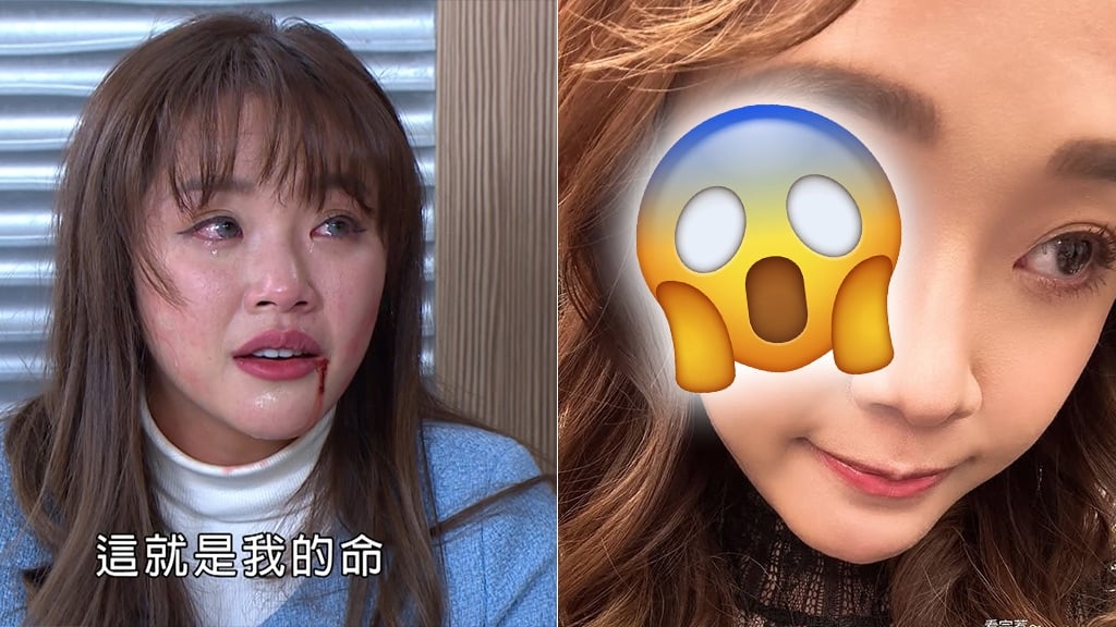 賴慧如婚禮前夕驚見大片血紅！揭《好運來》職業傷害：「是麗美愛哭」