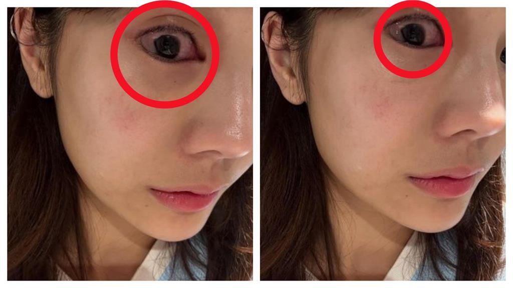 啦啦隊女神琳妲凌晨突發病痛！急衝醫院卻碰壁…曬照曝光真相嚇壞粉絲