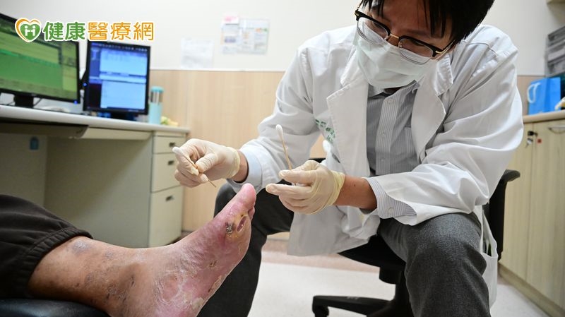 體重破百男腳底滲血嚇見「整層皮脫落」！　醫揭關鍵病因：恐截肢