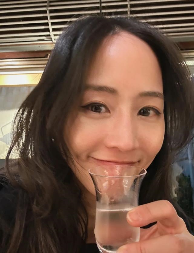 才傳股票慘賠千萬！張鈞甯瀏海掀開「髮際線退潮」判若兩人…中網驚：怎麼禿了