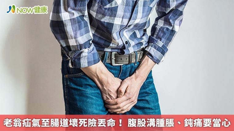 老翁疝氣至腸道壞死險丟命！ 腹股溝腫脹、鈍痛要當心