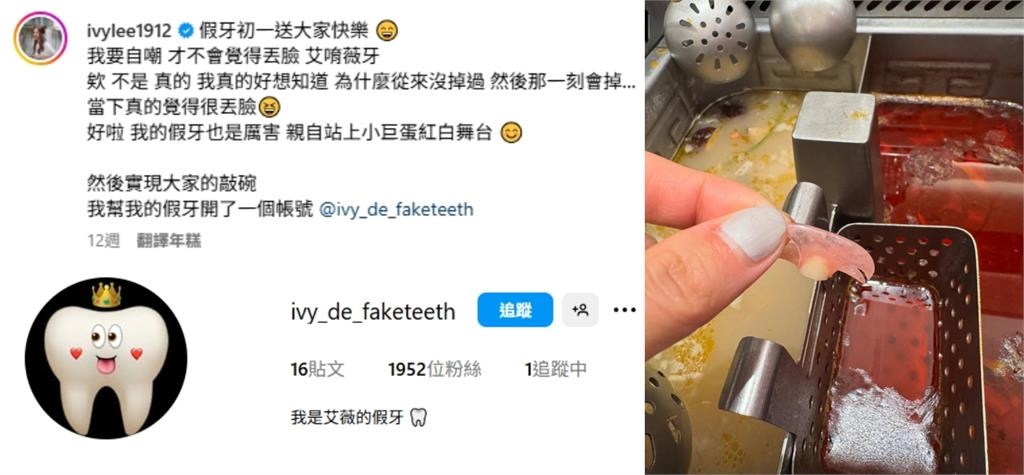 蕭敬騰師妹「假牙掉在小巨蛋」心都碎了！拍片自嘲「真厲害」300萬人笑瘋