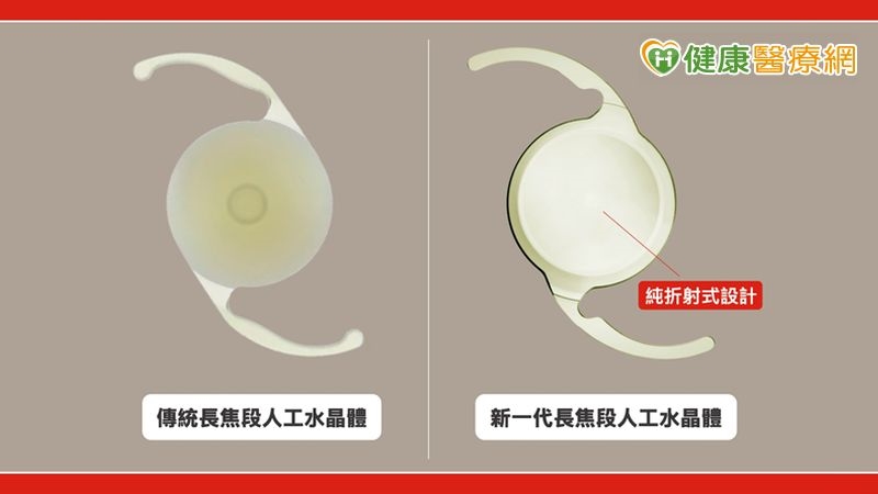 45歲男主管近視暴增700度!醫:成人度數增加注意「這眼疾」