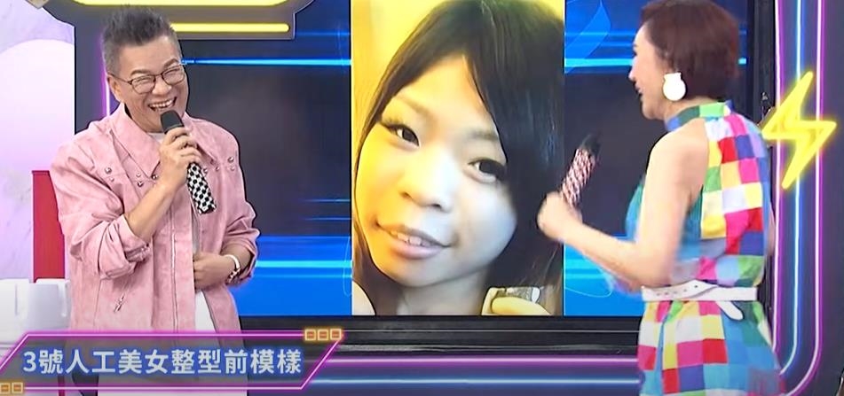 35歲正妹砸近3百萬「換頭大改造」!舊照「驚人對比」震撼網:勵志