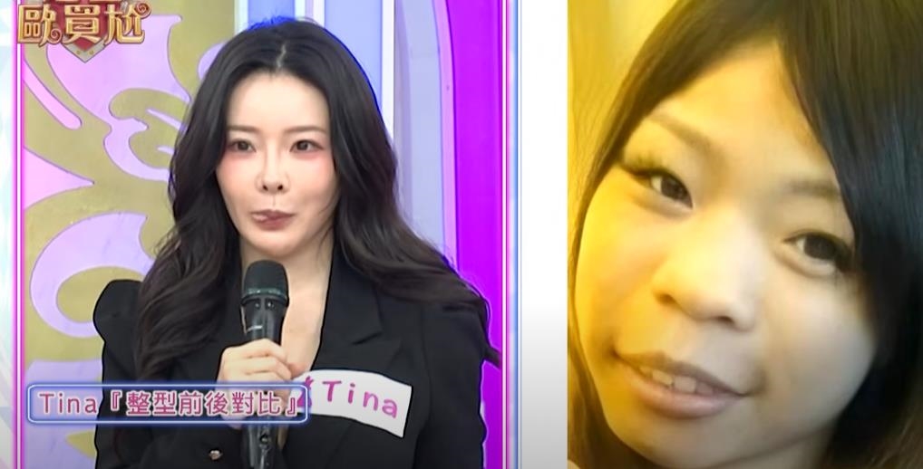 35歲正妹砸近3百萬「換頭大改造」!舊照「驚人對比」震撼網:勵志