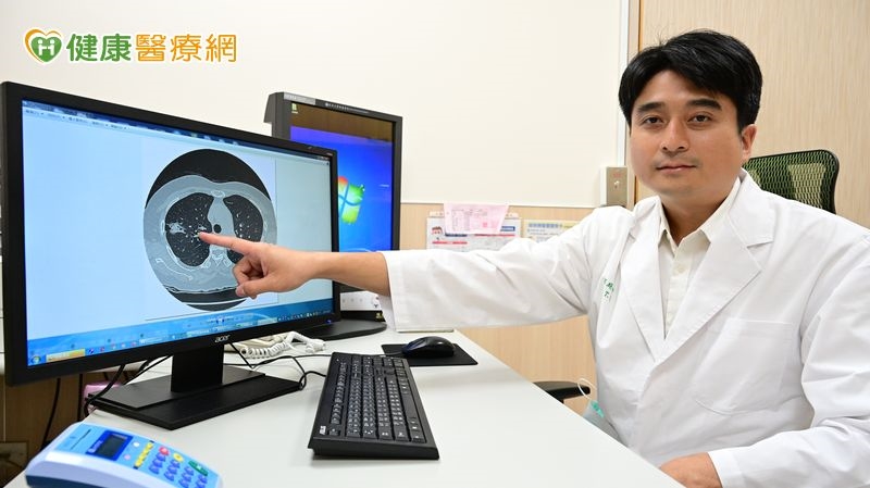 老婦「肺小結節」定期追蹤十年卻變癌 機器手臂切除救回一命