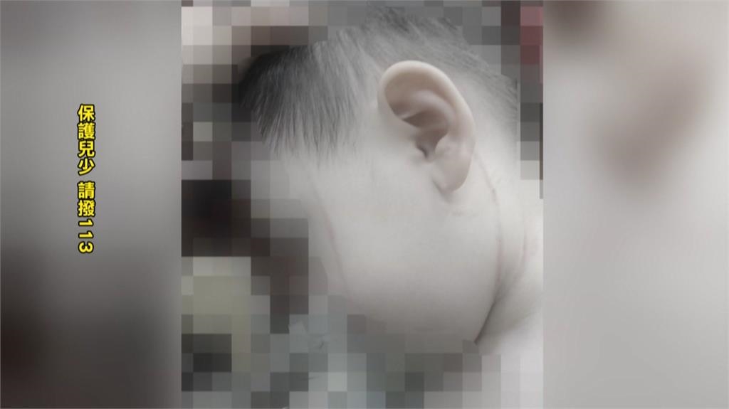 台中又爆私托疑虐童！　２歲童疑因「丟積木」遭巴頭捏脖抓傷