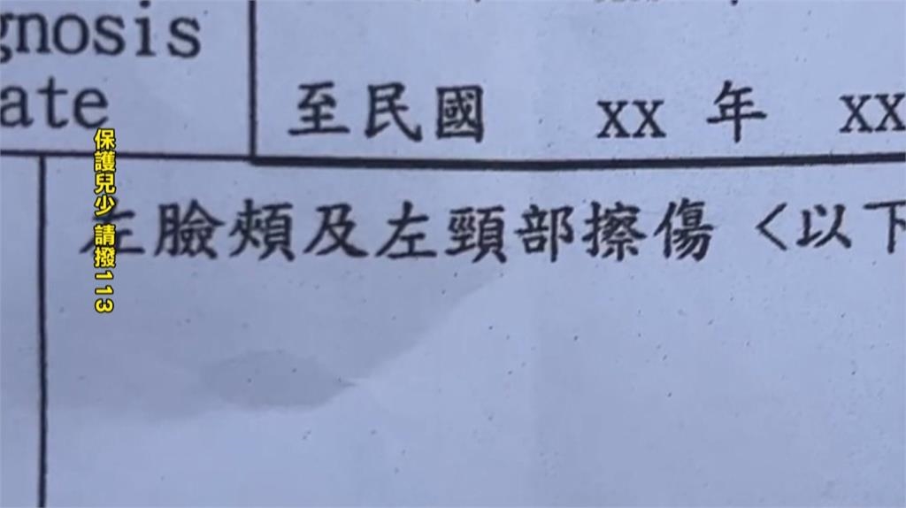 台中又爆私托疑虐童！　２歲童疑因「丟積木」遭巴頭捏脖抓傷