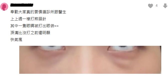 淚溝打完眼周腫成眼袋?醫揭「熊貓針vs玻尿酸」挑選訣竅:選錯針劑反而更顯老