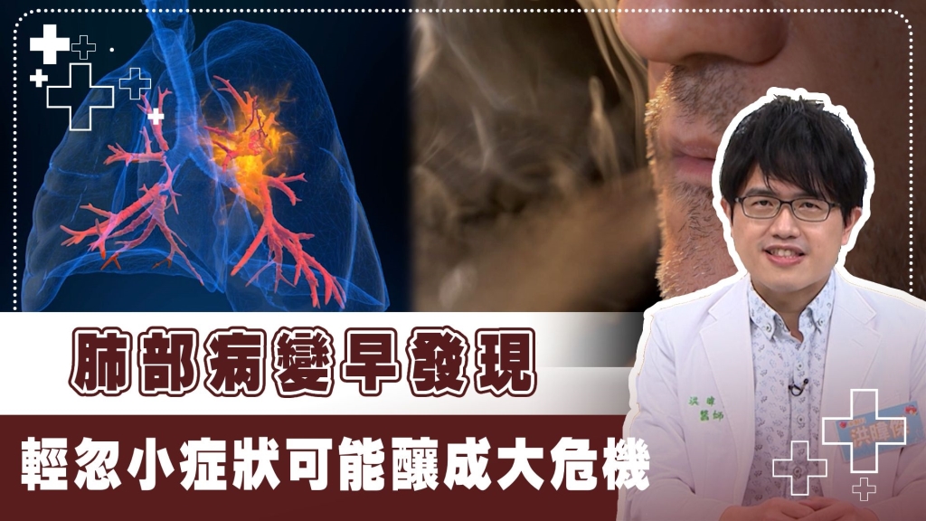 咳嗽帶血聲音沙啞小心「肺癌」找上門！洪暐傑：二大類肺癌民眾要認識！