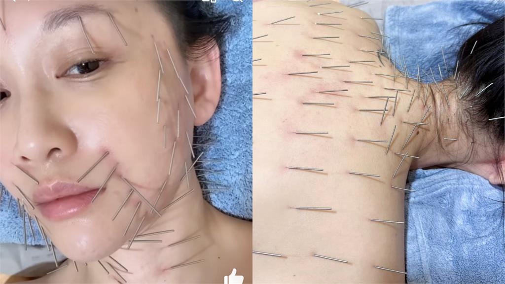 46歲陳喬恩曝「保養祕訣」 驚悚畫面嚇壞網友:對自己太狠了!