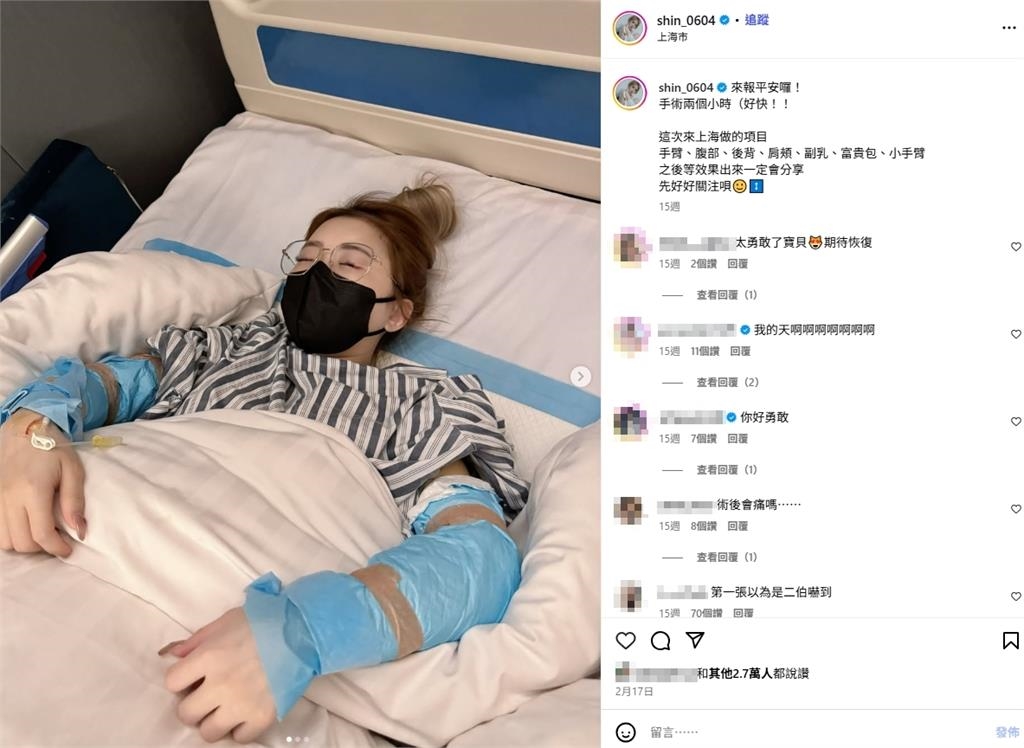 饅頭媽認了！全網羨慕「火辣身材」是整的　驚人舊照曝光：去中國抽脂