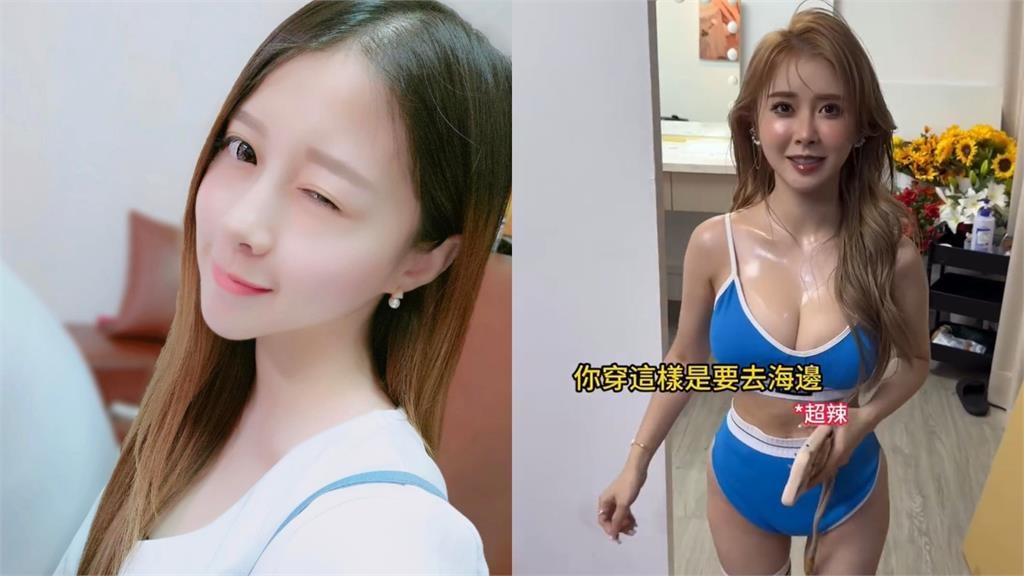 饅頭媽認了！全網羨慕「火辣身材」是整的　驚人舊照曝光：去中國抽脂