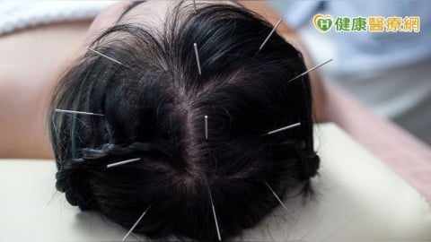 腦中風別錯過黃金期! 「中醫針灸+中藥調理」助加速復原