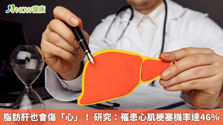 脂肪肝也會傷「心」! 研究:罹患心肌梗塞機率達46% 脂肪肝也會傷「心」! 研究:罹患心肌梗塞機率達46%