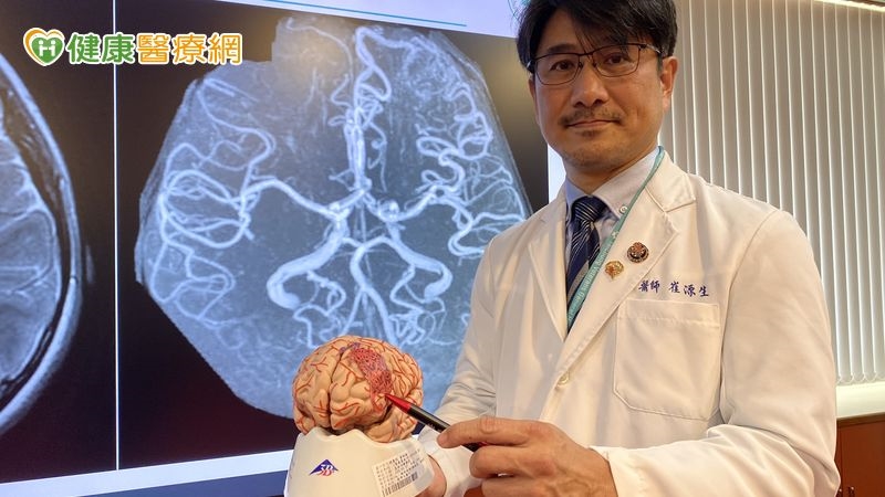 9歲癲癇、4歲頭痛竟是顱內動靜脈畸形! AR導航助精準拆彈救命