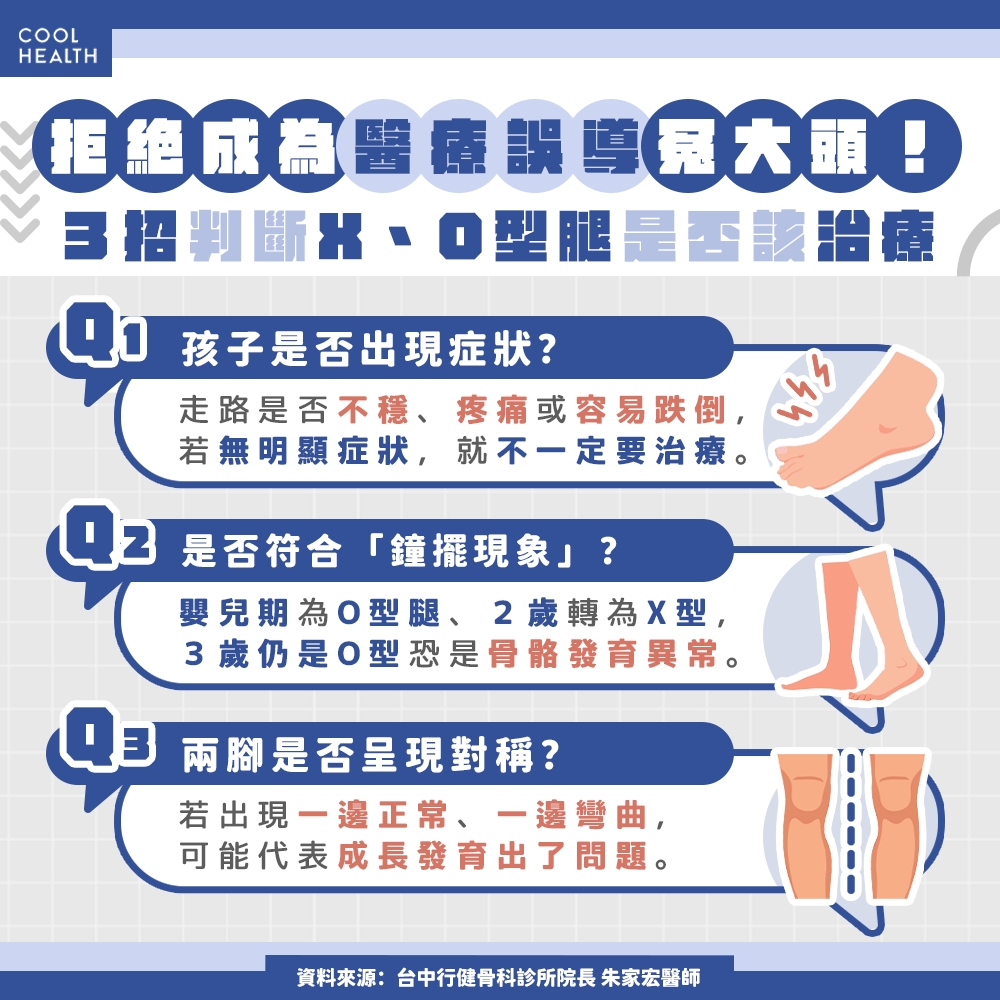 O型腿該不該矯正? 醫揭真相:並沒有「非治不可」,小心被誤導淪為冤大頭