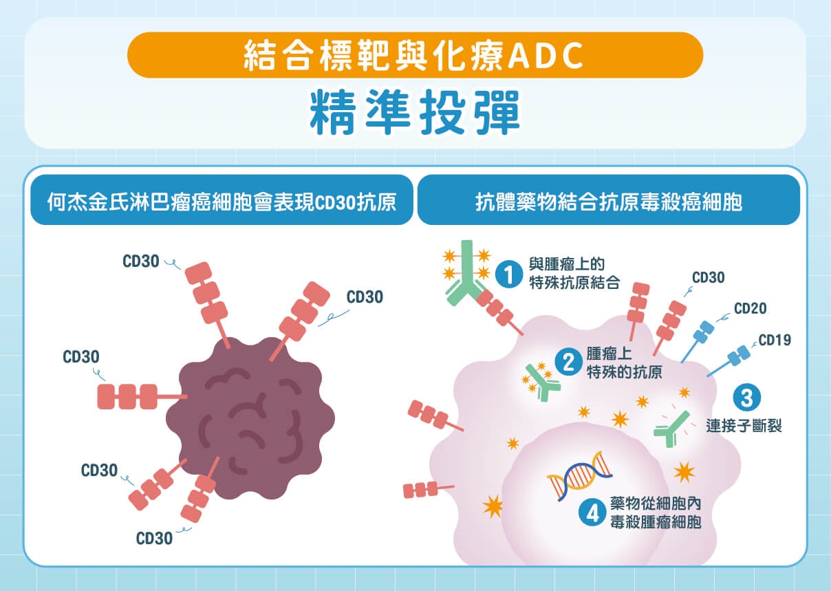 發現淋巴癌先別慌!何杰金氏淋巴癌治癒機會高!