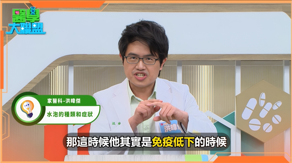 醫警:水泡出現勿當過敏!免疫拉警報3招教你預防之道