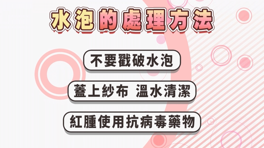 醫警:水泡出現勿當過敏!免疫拉警報3招教你預防之道