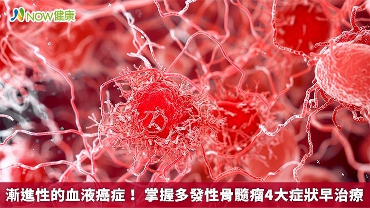 漸進性的血液癌症! 掌握多發性骨髓瘤4大症狀早治療 漸進性的血液癌症! 掌握多發性骨髓瘤4大症狀早治療
