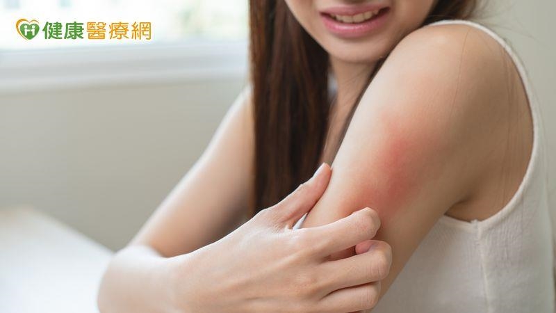 堅信自己遭蟲子纏身?皮膚醫解析何謂「妄想寄生蟲病」 家屬陪伴是治療關鍵 堅信自己遭蟲子纏身?皮膚醫解析何謂「妄想寄生蟲病」 家屬陪伴是治療關鍵
