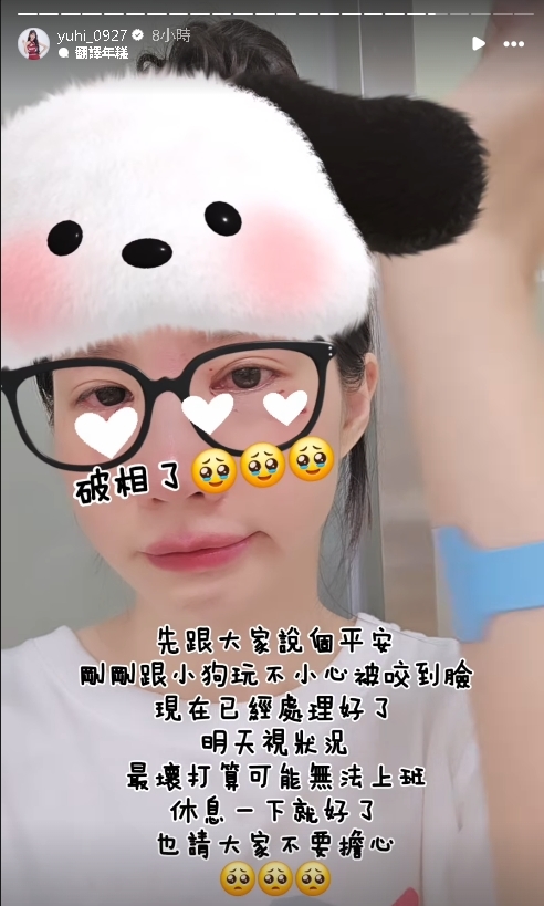 樂天女孩遭「愛犬咬破相」急送醫!「眼下血狂流」畫面曝光…她嘆:恐無法上班