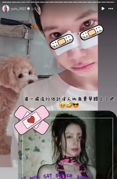 樂天女孩遭「愛犬咬破相」急送醫!「眼下血狂流」畫面曝光…她嘆:恐無法上班