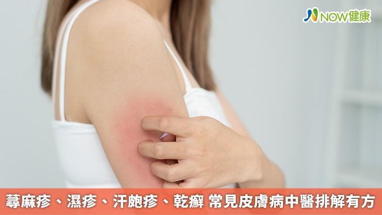 蕁麻疹、濕疹、汗皰疹、乾癬 常見皮膚病中醫排解有方