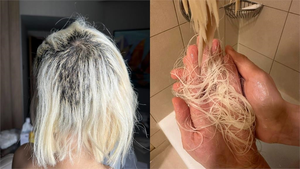 DJ SODA「頭髮掉光」光禿一片！深夜突公開「震撼真面目」：努力找回自己