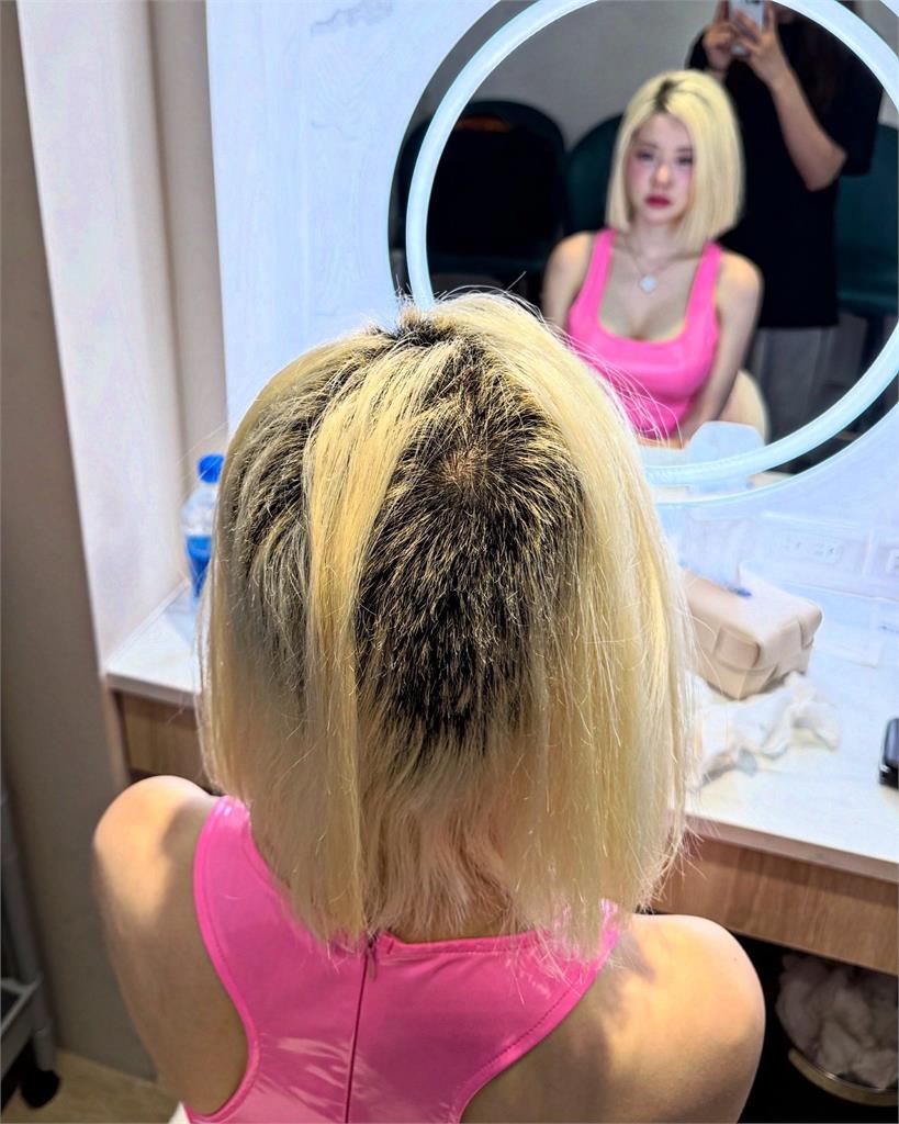 DJ SODA「頭髮掉光」光禿一片！深夜突公開「震撼真面目」：努力找回自己