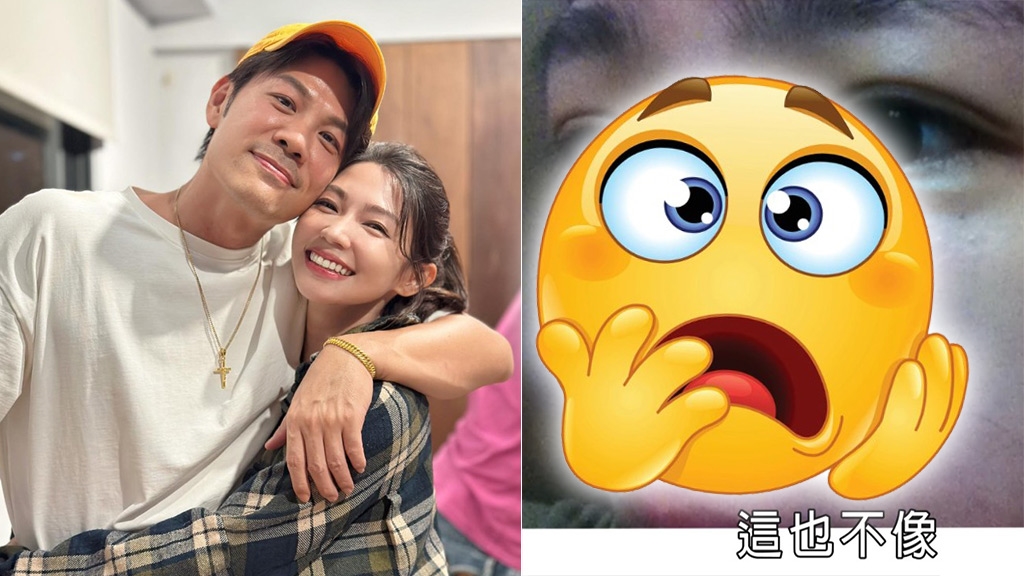 曾智希面子出事險毀容！驚悚「大片紅腫」曝光遭疑：被陳志強家暴？