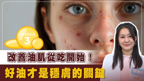痘痘狂冒、油光滿面　營養師：皮脂腺造成膚況惡化都因「這3成份」！