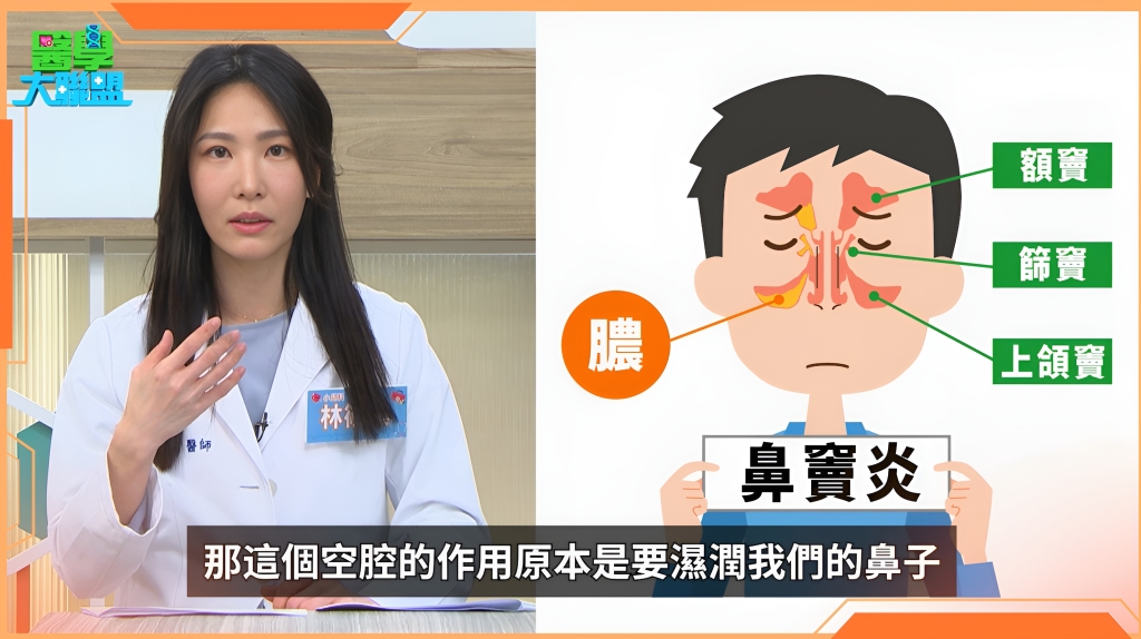 黃鼻涕流不停、口臭薰死人?小心!醫揭:不只感冒「鼻竇炎」找上門!