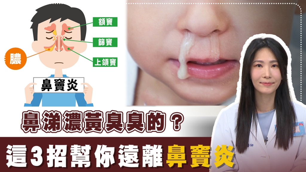 黃鼻涕流不停、口臭薰死人？小心！醫揭：不只感冒「鼻竇炎」找上門！