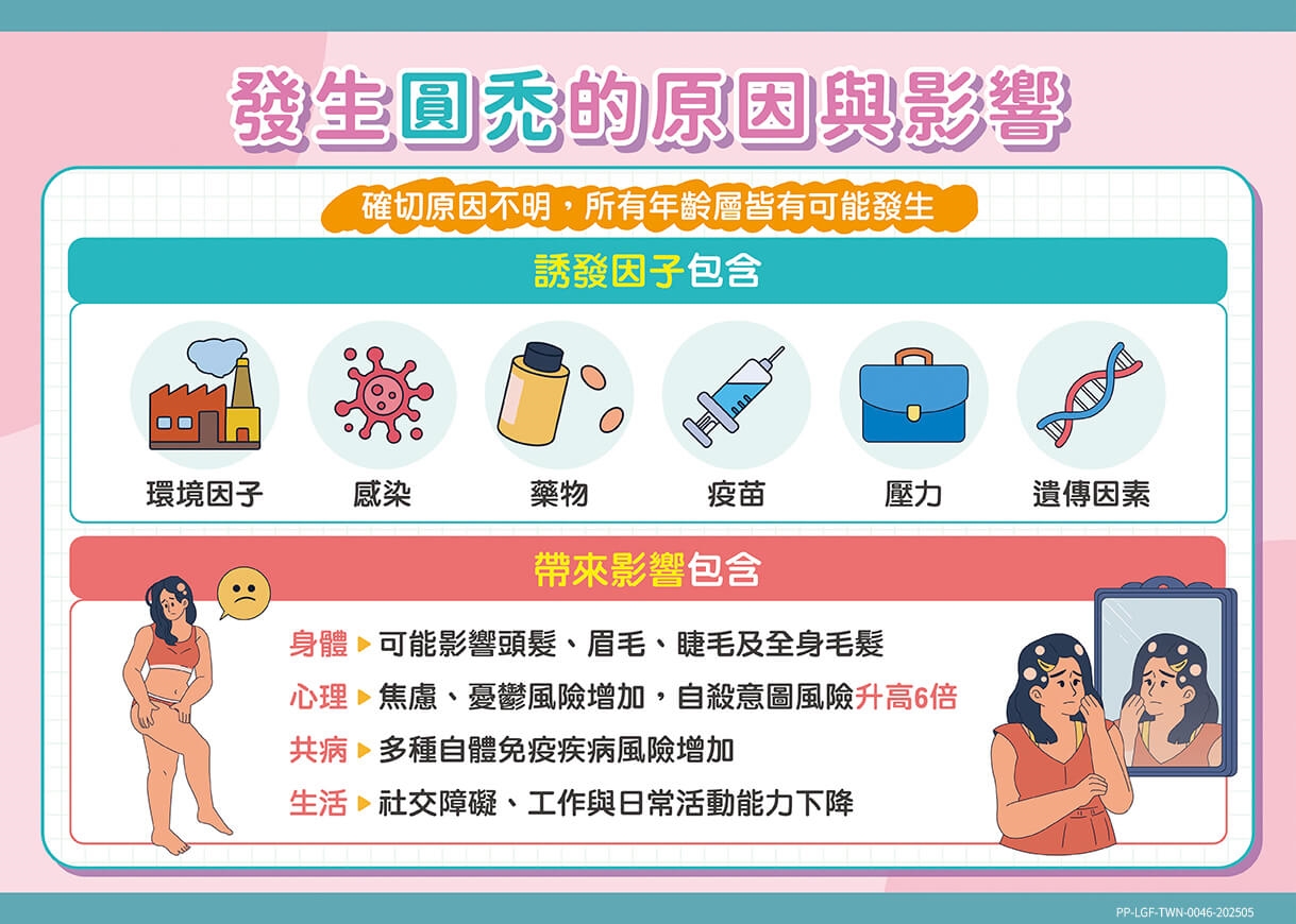 發現圓禿該怎麼辦？對抗圓禿應該瞭解的正確治療關鍵