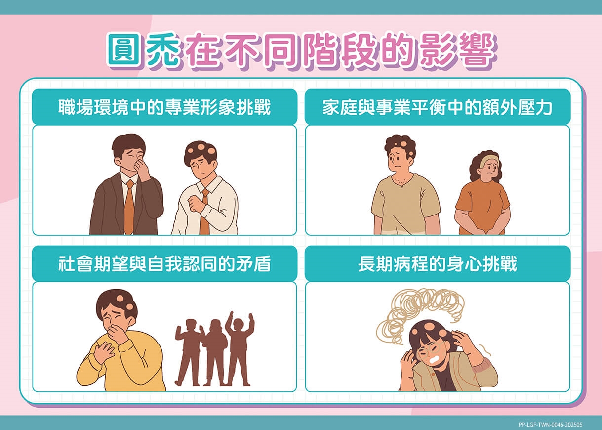 發現圓禿該怎麼辦？對抗圓禿應該瞭解的正確治療關鍵