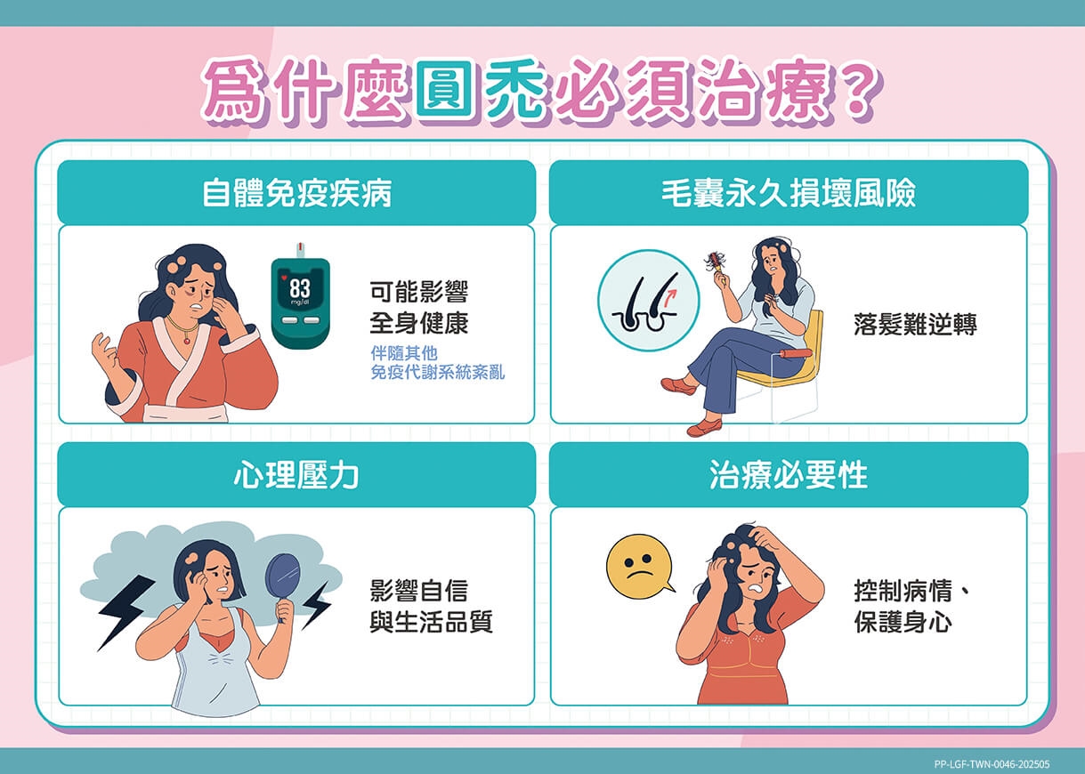 發現圓禿該怎麼辦？對抗圓禿應該瞭解的正確治療關鍵