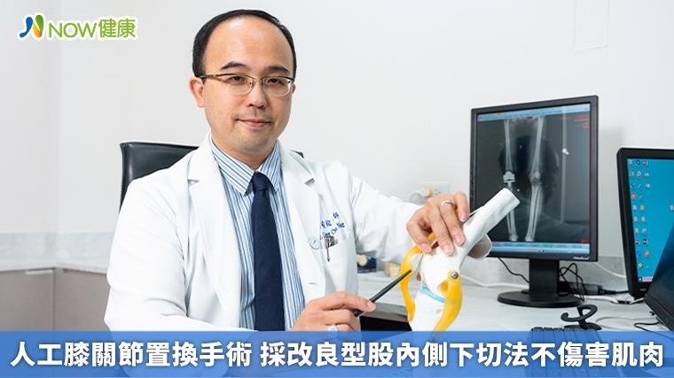 人工膝關節置換手術 採改良型股內側下切法不傷害肌肉