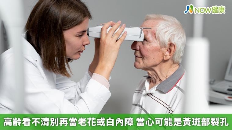 高齡看不清別再當老花或白內障 當心可能是黃斑部裂孔