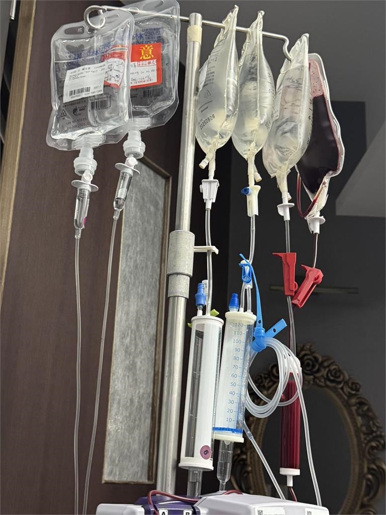 陳文茜身體冒紫青斑爆4症齊發!「吊5包點滴1血袋」最新病況曝萬網急關切