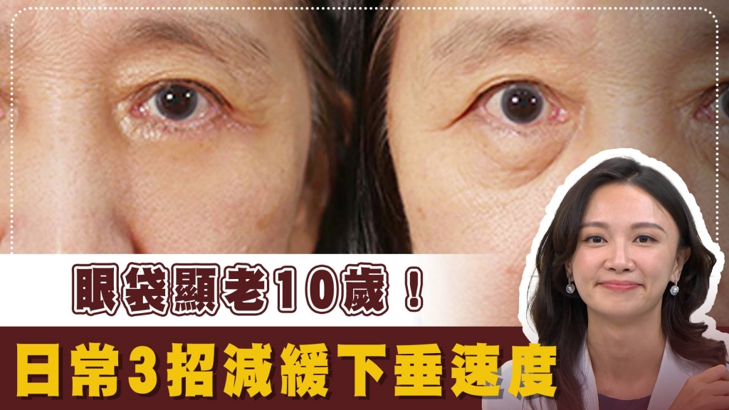 不想動刀也能告別「垂墜熊貓眼」?醫揭「3招回春」眼袋可能還有救! 不想動刀也能告別「垂墜熊貓眼」?醫揭「3招回春」眼袋可能還有救!