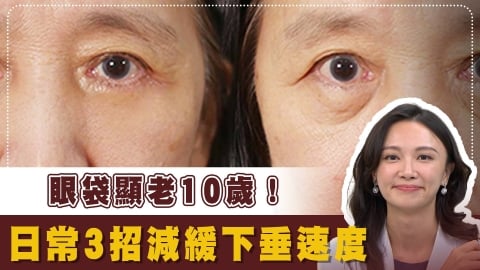 不想動刀也能告別「垂墜熊貓眼」？醫揭「3招回春」眼袋可能還有救！
