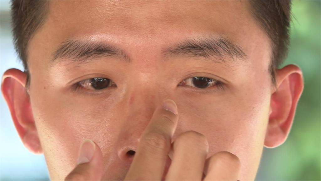 遭男子雨傘戳到左眼「創傷結膜眼」 事後竟已讀不回、封鎖電話