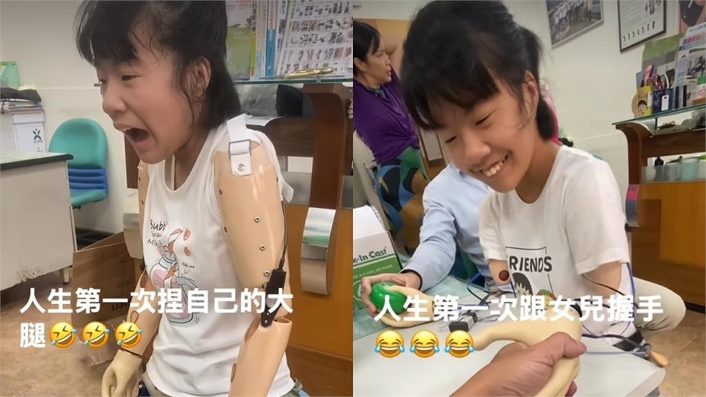 「單腳天使」徐又立裝義肢「首次與爸爸握手」畫面曝！父感動：等了12年