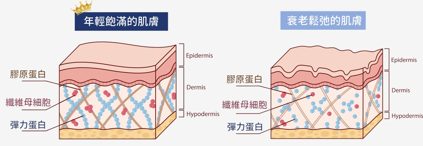 Profhilo逆時針正式登台!5點拉提「液態電波」啟動彈力蛋白修復再生