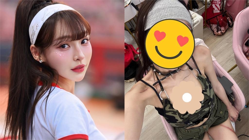 林襄變「重傷版女神」臉傷腿裂畫面流出 網看傻:以為出事了 林襄變「重傷版女神」臉傷腿裂畫面流出 網看傻:以為出事了