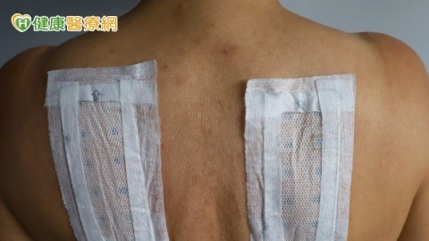 一變天就鼻塞？中醫師：三伏貼改善鼻炎有幫助　但這些人要慎用