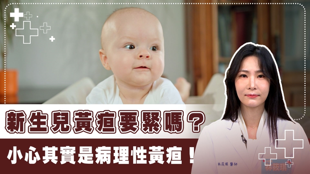 家長必看！新生兒黃疸莫輕忽！　病理性警訊3招觀察重點一次看