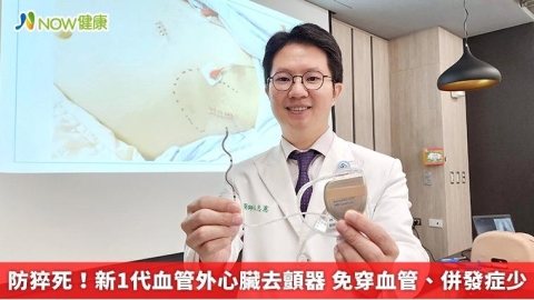 防猝死！新1代血管外心臟去顫器 免穿血管、併發症少